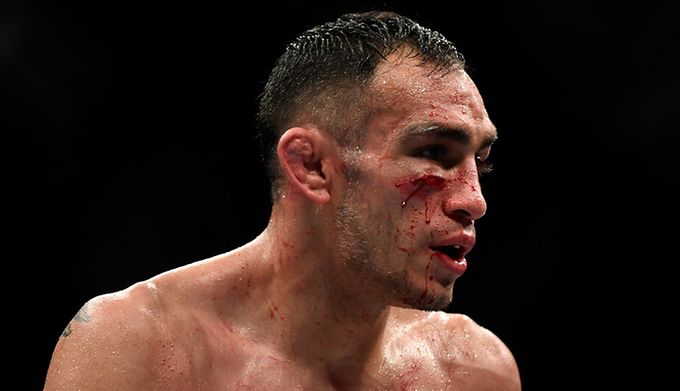 Tony Ferguson